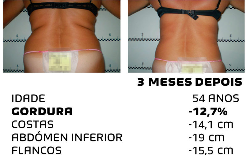 Comment faire pour maigrir rapidement - photos avant et après - Photo 1