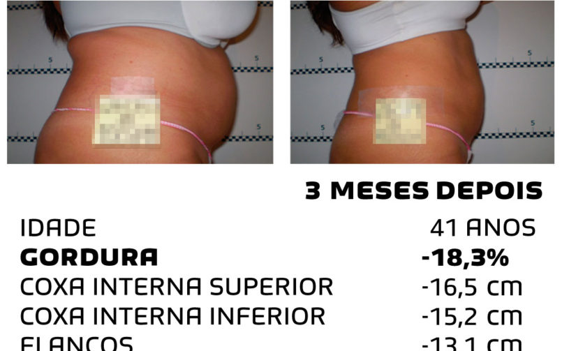 Comment faire pour maigrir rapidement - photos avant et après - Photo 13