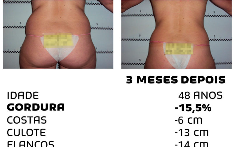 Comment faire pour maigrir rapidement - photos avant et après - Photo 14