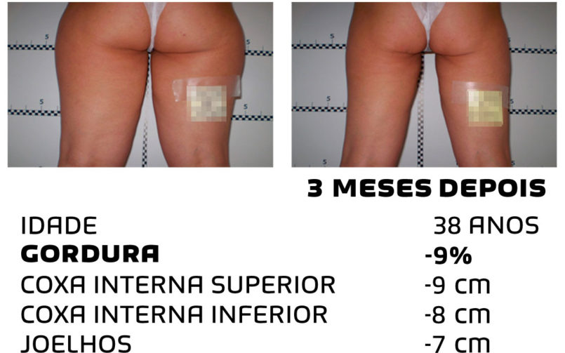 Comment faire pour maigrir rapidement - photos avant et après - Photo 2