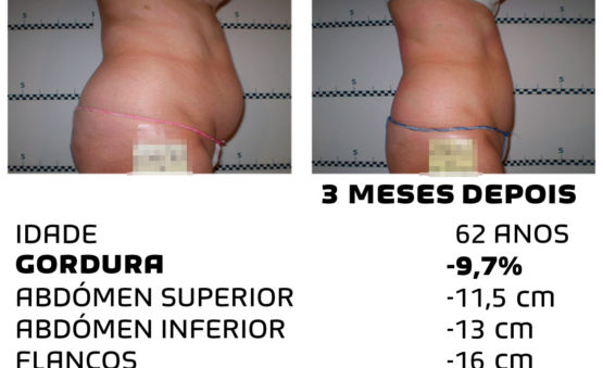 Comment faire pour maigrir rapidement - photos avant et après - Photo 22
