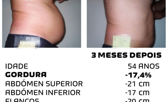 Comment faire pour maigrir rapidement - photos avant et après - Photo 24