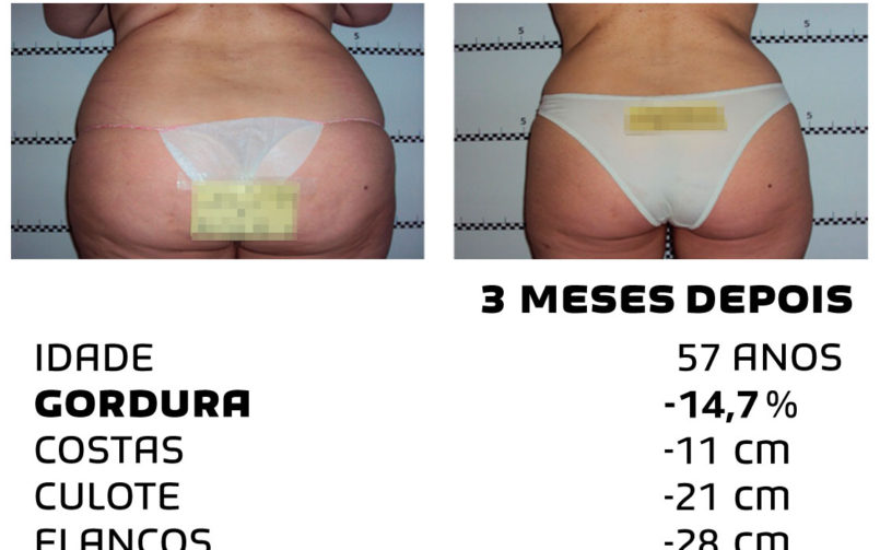Comment faire pour maigrir rapidement - photos avant et après - Photo 27