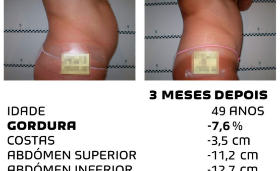 Comment faire pour maigrir rapidement - photos avant et après - Photo 28