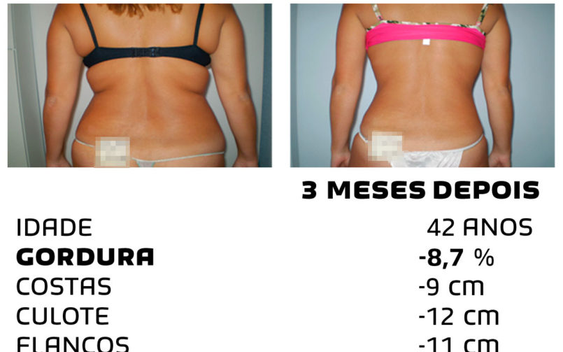 Comment faire pour maigrir rapidement - photos avant et après - Photo 29