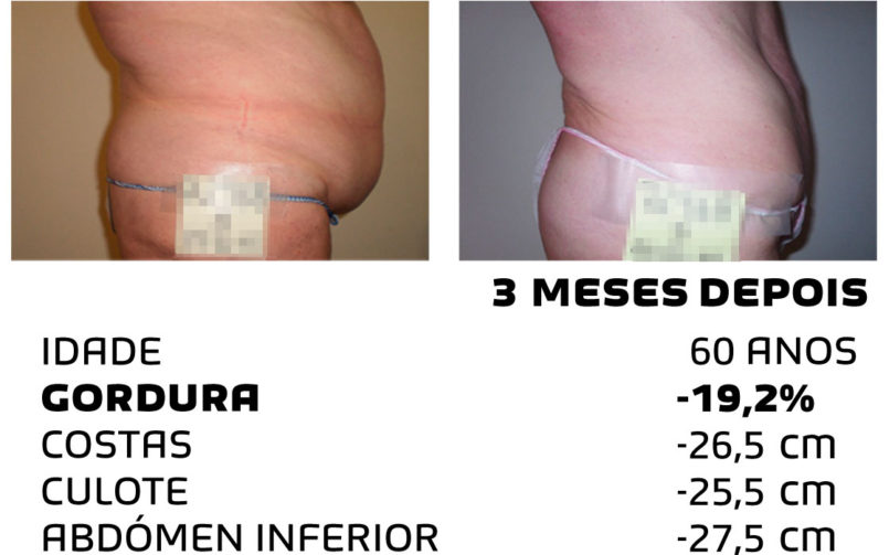 Comment faire pour maigrir rapidement - photos avant et après - Photo 3