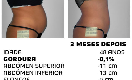 Comment faire pour maigrir rapidement - photos avant et après - Photo 30