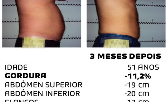 Comment faire pour maigrir rapidement - photos avant et après - Photo 32