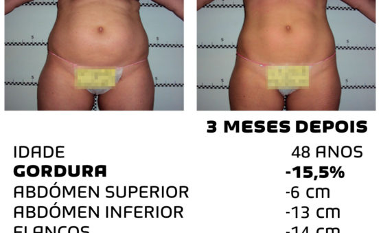 Comment faire pour maigrir rapidement - photos avant et après - Photo 33