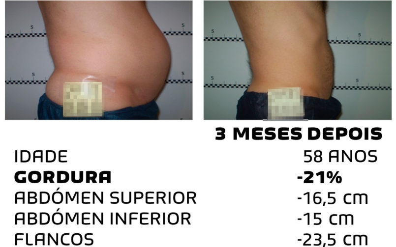 Comment faire pour maigrir rapidement - photos avant et après - Photo 4