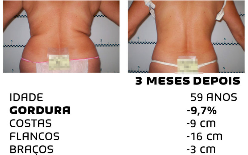 Comment faire pour maigrir rapidement - photos avant et après - Photo 5