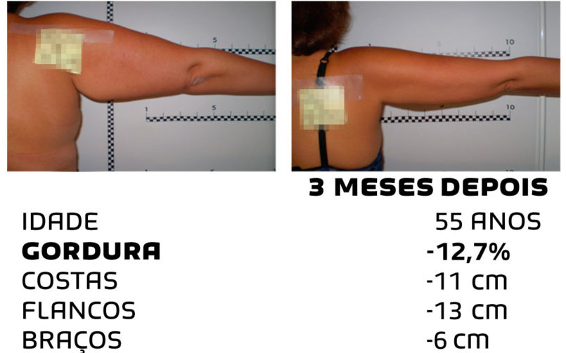 Comment faire pour maigrir rapidement - photos avant et après - Photo 6