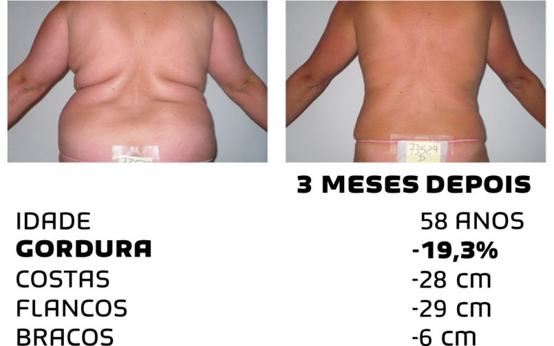 Comment faire pour maigrir rapidement - photos avant et après - Photo 8