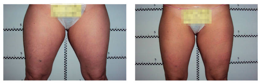 foto-antes-depois-10