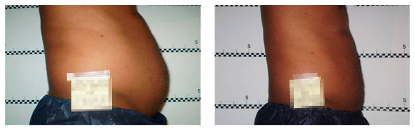 foto-antes-depois-12