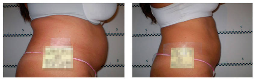 foto-antes-depois-13