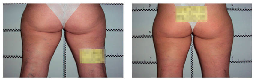 foto-antes-depois-15