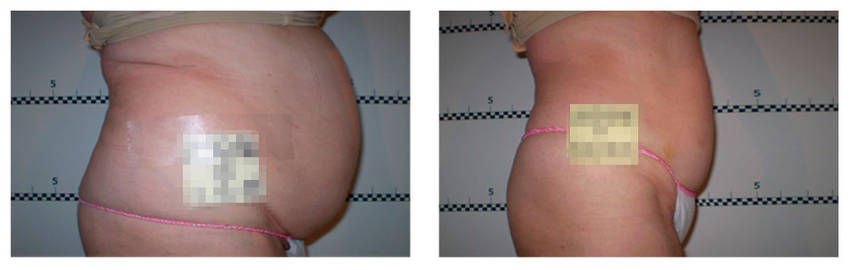 foto-antes-depois-16