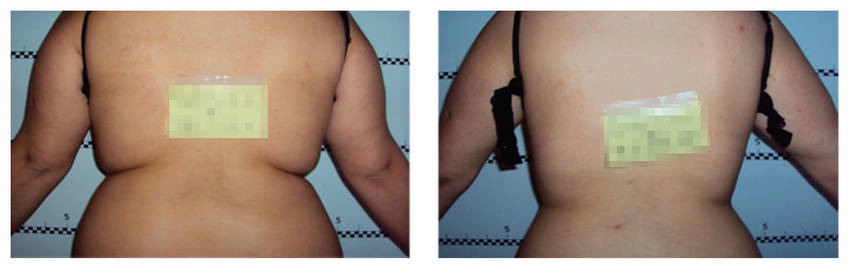 foto-antes-depois-17