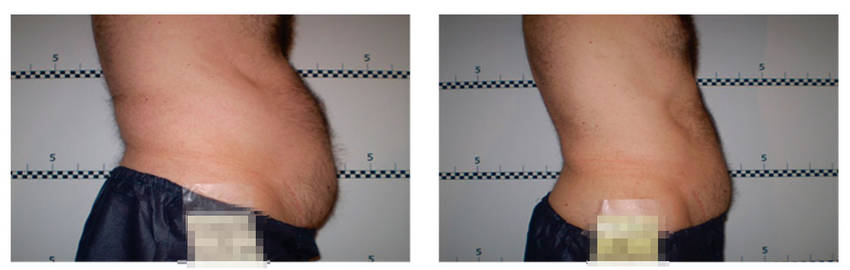 foto-antes-depois-18