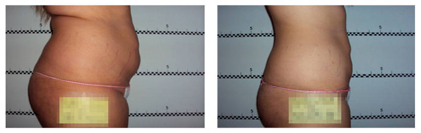 foto-antes-depois-19