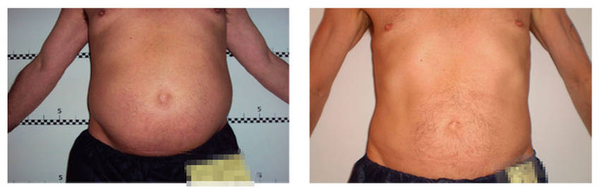 foto-antes-depois-21