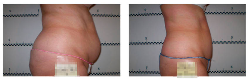 foto-antes-depois-22