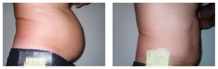 foto-antes-depois-24