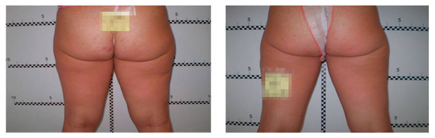 foto-antes-depois-25