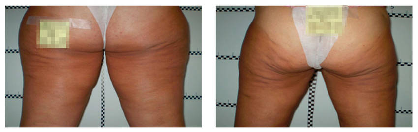 foto-antes-depois-26