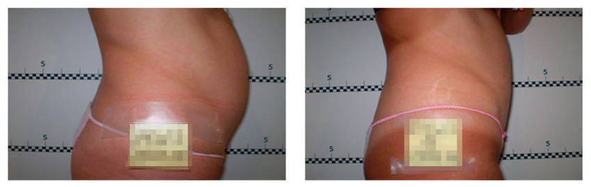 foto-antes-depois-28