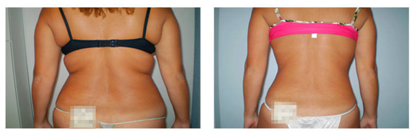 foto-antes-depois-29