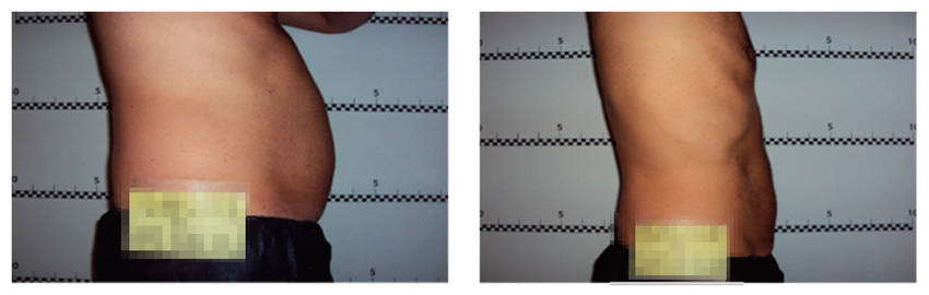 foto-antes-depois-34